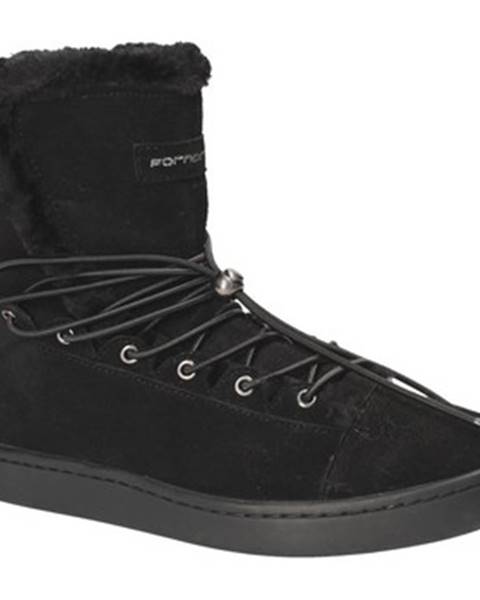 Čierne topánky Fornarina